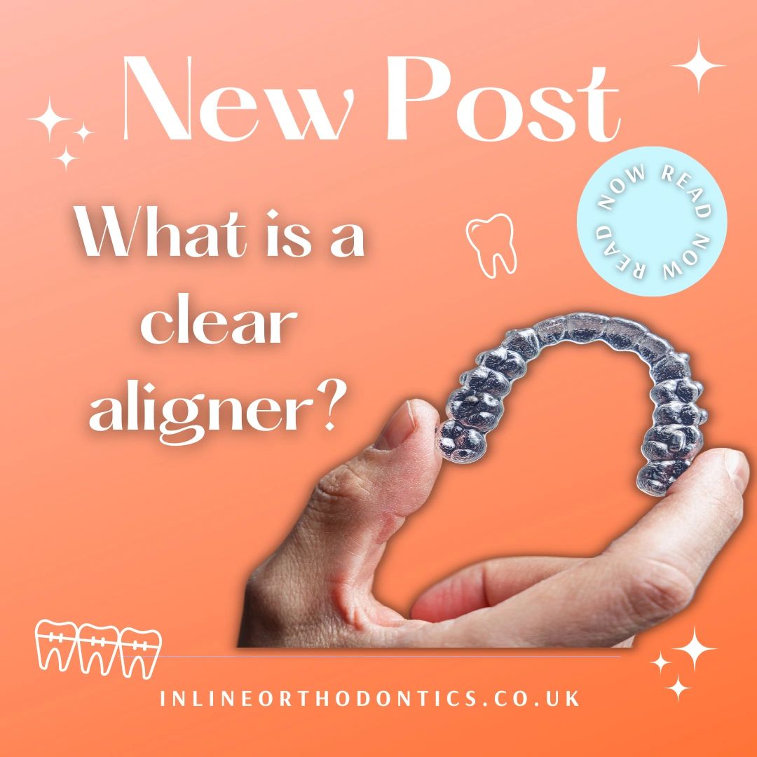 What is a Clear Aligner Advantages and Disadvantages